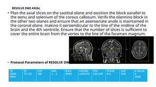 MRI BRAIN PROTOCOL- PRESENTED BY SHUBHASHIS MONDAL | PPTX