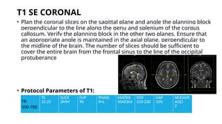 Splenium Mri Con Ronal MRI BRAIN PROTOCOL- PRESENTED BY SHUBHASHIS MONDAL | PPTX