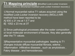 Inversion Locker Mri cardic imaging | PPTX