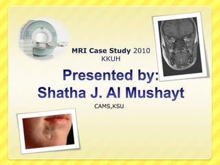 MRI Case Study 2010
KKUH
CAMS,KSU
 