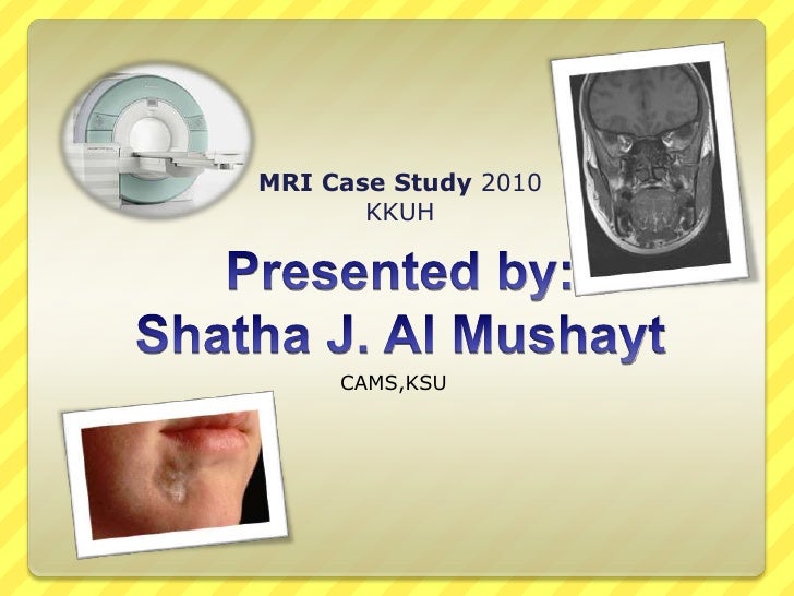 Mri case study presentation image