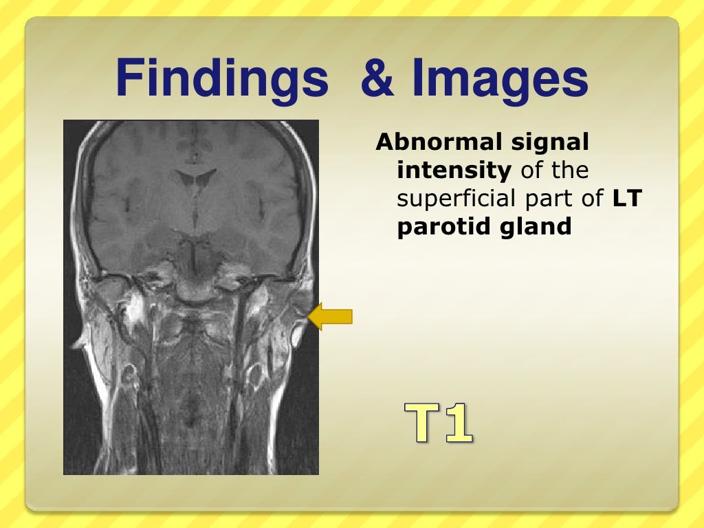 Epilepsy case study image