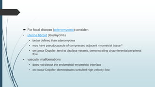  For focal disease (adenomyoma) consider:
• uterine fibroid (leiomyoma)
• better defined than adenomyoma
• may have pseudocapsule of compressed adjacent myometrial tissue 5
• on colour Doppler: tend to displace vessels, demonstrating circumferential peripheral
flow
• vascular malformations
• does not disrupt the endometrial-myometrial interface
• on colour Doppler: demonstrates turbulent high-velocity flow
 