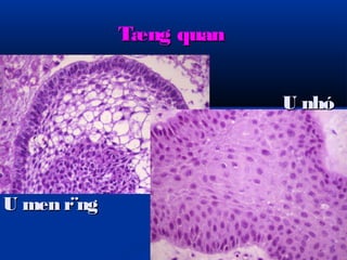 TTæænngg qquuaann 
UU mmeenn rr¨nngg 
UU nnhhóó 
 