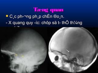 TTæænngg qquuaann 
 CC¸cc pphh­­ 
¬nngg pphh¸pp cchhÈÈnn ®oo¸nn.. 
-- XX qquuaanngg qquuyy ­­íícc:: 
cchhôôpp ssää tt­­tthhÕÕ 
tthh¼nngg 
nngghhiiªnngg 
 