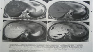 MRI CONTRAST AGENTS USED IN RADIODIAGNOSIS | PPTX
