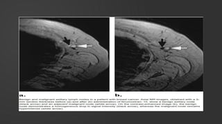 MRI CONTRAST AGENTS USED IN RADIODIAGNOSIS | PPTX