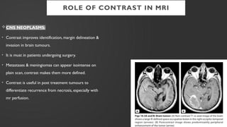 MRI CONTRAST AGENTS USED IN RADIODIAGNOSIS | PPTX