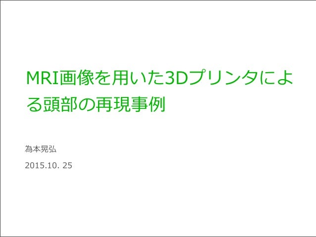 Mri画像を用いた3dプリンタによる頭部の再現事例 Mri画像を用いた3dプリンタによる頭部の再現事例