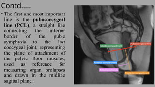 Pcl Line Magnetic Resonance Imaging Defecograhy technique | PPTX