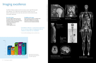 Imaging excellence




                                                                                                                                                   All images taken with SmartPath to dStream digital broadband MR
               SmartPath to dStream architecture and dS coil solutions results in high SNR that benefit
               every application. You no longer have to trade resolution for speed: now you can
               perform routine exams for brain, spine, knee, ankle and liver within less than 8 minutes
               with excellent image quality.


               Fast routine imaging                                                  dS-SENSE parallel imaging
                                                                                                                                                                                                                     Enhanced SNR and coverage                              Extended coverage
               Fast routine imaging is enabled by dStream (dS)                       Powered by dStream architecture, dS-SENSE enables
                                                                                                                                                                                                                     PDW TSE SmartPath to dStream with                      dSTorso, 500 mm Field of View T2W TSE
               coil solutions tailored to your clinical needs and                    higher parallel imaging factors for more speed
                                                                                                                                                                                                                     Flex M plus dSPosterior
               addressing a full range of clinical situations, dStream               and resolution. It includes quick, fully integrated
               coil solutions and have been optimized for:                           reference scans which are planned automatically.
               •	Intrinsic signal-to-noise ratio.
                                                                                                                                                                                                                                          
               •	Imaging coverage.
                                                                                                                                                                                                                                          Enhanced workflow
               •	Parallel imaging performance.
                                                                                                                                                                                                                                          2 station total Spine
                                                                                                                                                                                                                                          T2W TSE with integrated
                                                                        “SmartPath to dStream is a phenomenal opportunity                                                                                                                 dSTotalSpine

                                                                         for us: not only to keep us contemporary, but to
                                                                         maintain our lead over our competition“
                                                                        	 Chip Truwit MD, Chief of Radiology, Hennepin County Medical Center.
                                                                         Dr.




                                                                                                                                                                                                                                                         
                                                                                                                                                                                                                                                         Enhanced workflow
                                                                                                                                                                                                                                                         and SNR
                                                                                                                                                                                                                                                         3 station total Torso
    Minutes
                                                                                                                                                                                                                                                         DWIBS with dSHeadNeck
          8
                                                                                                                                                                                                                                                         and dSTorso



          6




          4                                                 T2 Cor
                                                            T1 3D IP
                                                            T1 3D OP
                                                            Diffusion
                                                            T2 Ax
          2         T1             T1 Ax                    T2 Ax F/S       STIR Sag
                    T2             PD Sag       T1 Sag      Function        PD Cor
                    Flair          T2 Sag F/S   T2 Sag      T1 3D art.      PD Cor F/S
                    DWI            PD Cor F/S   T2 TSE Ax   T1 3D portal    T1 Cor
                    T2*            T2 Cor       BFFE Ax     T1 3D venous    PD Ax F/S                Routine exams for brain, spine, knee,
          0
                         Brain        Knee        C-spine       Liver        Foot/ankle              ankle, and liver all within less than 8 min
                                                                                                                                                                                                                     Enhanced volumetric imaging
                                                                                                     with excellent image quality.
                                                                                                                                                                                                                     3D BrainView FLAIR with dS-SENSE 5; 1.1mm3 isotropic resolution in 4:53                        Fast whole body imaging
                                                                                                                                                                                                                     minutes. Sagittal source image and axial MPR.                                                  T2W TSE in 5 minutes with dSTorso and dS-SENSE


8      The smart approach to digital MR
 