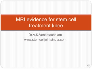 Dr.A.K.Venkatachalam
www.stemcelljointsindia.com
MRI evidence for stem cell
treatment knee
 
