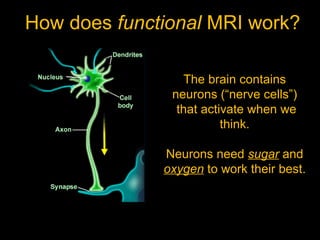 MRI explained