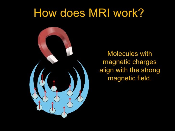 MRI explained