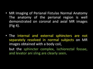• MR Imaging of Perianal Fistulas Normal Anatomy
The anatomy of the perianal region is well
demonstrated on coronal and axial MR images
(Fig 4).
• The internal and external sphincters are not
separately resolved in normal subjects on MR
images obtained with a body coil,
but the sphincter complex, ischiorectal fossae,
and levator ani sling are clearly seen.
 
