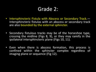 Grade 2:
• Intersphincteric Fistula with Abscess or Secondary Track.—
Intersphincteric fistulas with an abscess or secondary track
are also bounded by the external sphincter.
• Secondary fistulous tracks may be of the horseshoe type,
crossing the midline (Figs 8, 9), or they may ramify in the
ipsilateral intersphincteric plane (Figs 10, 11).
• Even when there is abscess formation, this process is
confined within the sphincter complex regardless of
imaging plane or sequence (Fig 12).
 