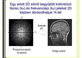 Egy adott 2D síkról begyűjtött különböző
fázisú (kx) és frekvenciájú (ky) jeleket 2D
képben ábrázolhatjuk: K-tér
 