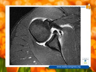 AMSTERDAM / THE NETHERLANDS
www.esska-congress.org
12
 