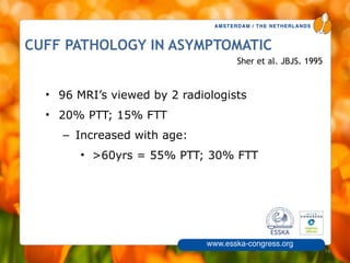AMSTERDAM / THE NETHERLANDS
www.esska-congress.org
CUFF PATHOLOGY IN ASYMPTOMATIC
• 96 MRI’s viewed by 2 radiologists
• 20% PTT; 15% FTT
– Increased with age:
• >60yrs = 55% PTT; 30% FTT
16
Sher et al. JBJS. 1995
 