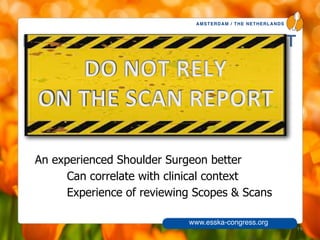 AMSTERDAM / THE NETHERLANDS
www.esska-congress.org
DO NOT RELY ON THE SCAN REPORT
An experienced Shoulder Surgeon better
Can correlate with clinical context
Experience of reviewing Scopes & Scans
19
 