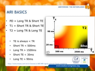 AMSTERDAM / THE NETHERLANDS
www.esska-congress.org
MRI BASICS
• PD = Long TR & Short TE
• T1 = Short TR & Short TE
• T2 = Long TR & Long TE
21
• TE is always < TR
• Short TR < 500ms
• Long TR > 1500ms
• Short TE < 30ms
• Long TE > 90ms
http://www.imaios.com/en/e-Courses/e-MRI/MRI-signal-contrast/Signal-weighting
 