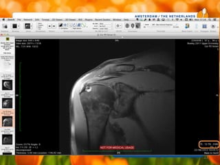 AMSTERDAM / THE NETHERLANDS
www.esska-congress.org
23
 