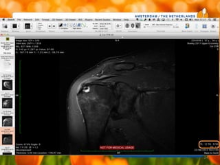 AMSTERDAM / THE NETHERLANDS
www.esska-congress.org
24
 