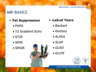 AMSTERDAM / THE NETHERLANDS
www.esska-congress.org
MRI BASICS
• Fat Suppression
• PDFS
• T2 Gradient Echo
• STIR
• SPIR
• SPAIR
25
• Labral Tears
• Bankart
• Perthes
• ALPSA
• SLAP
• GLAD
• GLOM
 