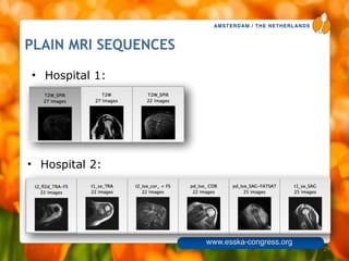 AMSTERDAM / THE NETHERLANDS
www.esska-congress.org
PLAIN MRI SEQUENCES
29
• Hospital 1:
• Hospital 2:
 