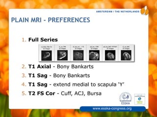 AMSTERDAM / THE NETHERLANDS
www.esska-congress.org
PLAIN MRI - PREFERENCES
32
1. Full Series
!
!
2. T1 Axial - Bony Bankarts
3. T1 Sag - Bony Bankarts
4. T1 Sag - extend medial to scapula ‘Y’
5. T2 FS Cor - Cuff, ACJ, Bursa
 