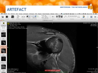 AMSTERDAM / THE NETHERLANDS
www.esska-congress.org
ARTEFACT
35
 
