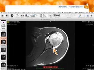 AMSTERDAM / THE NETHERLANDS
www.esska-congress.org
41
 