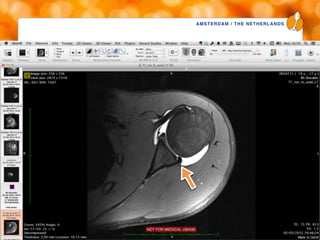 AMSTERDAM / THE NETHERLANDS
www.esska-congress.org
42
 
