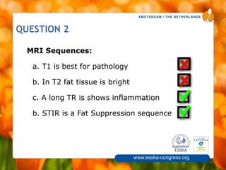 AMSTERDAM / THE NETHERLANDS
www.esska-congress.org
51
QUESTION 2
MRI Sequences:
a. T1 is best for pathology
b. In T2 fat tissue is bright
c. A long TR is shows inflammation
b. STIR is a Fat Suppression sequence
 