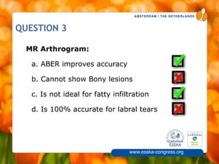 AMSTERDAM / THE NETHERLANDS
www.esska-congress.org
52
QUESTION 3
MR Arthrogram:
a. ABER improves accuracy
b. Cannot show Bony lesions
c. Is not ideal for fatty infiltration
d. Is 100% accurate for labral tears
 
