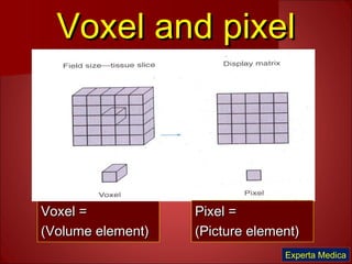 Voxel and pixelVoxel and pixel
Voxel =Voxel =
(Volume element)(Volume element)
Pixel =Pixel =
(Picture element)(Picture element)
Experta Medica
 