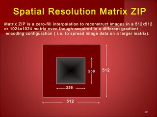 2020
512
512
256
256
Matrix ZIP is a zero-fill interpolation to reconstruct images in a 512x512
or 1024x1024 matrix even though acquired in a different gradient
encoding configuration ( i.e. to spread image data on a larger matrix).
Spatial Resolution Matrix ZIP
 