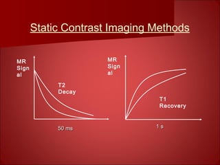 T2
Decay
MR
Sign
al
T1
Recovery
MR
Sign
al
50 ms50 ms 1 s1 s
Static Contrast Imaging Methods
 