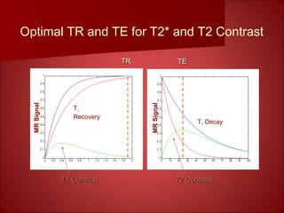Optimal TR and TE for T2* and T2 Contrast
0 0.2 0.4 0.6 0.8 1 1.2 1.4 1.6 1.8 2
0
0.1
0.2
0.3
0.4
0.5
0.6
0.7
0.8
0.9
1
0 10 20 30 40 50 60 70 80 90 100
0
0.1
0.2
0.3
0.4
0.5
0.6
0.7
0.8
0.9
1
T2 Decay
MRSignal
MRSignal
T1
Recovery
TRTR TETE
T1 ContrastT1 Contrast T2 ContrastT2 Contrast
 