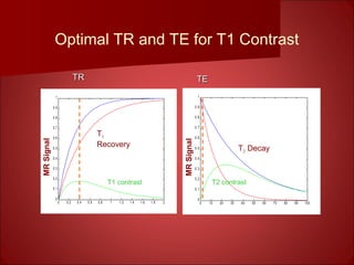 Optimal TR and TE for T1 Contrast
0 0.2 0.4 0.6 0.8 1 1.2 1.4 1.6 1.8 2
0
0.1
0.2
0.3
0.4
0.5
0.6
0.7
0.8
0.9
1
0 10 20 30 40 50 60 70 80 90 100
0
0.1
0.2
0.3
0.4
0.5
0.6
0.7
0.8
0.9
1
T1 contrast T2 contrast
T2 Decay
MRSignal
MRSignal
T1
Recovery
TRTR TETE
 