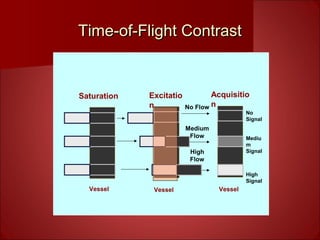 Time-of-Flight ContrastTime-of-Flight Contrast
No Flow
Medium
Flow
High
Flow
No
Signal
Mediu
m
Signal
High
Signal
Vessel
Acquisitio
n
Saturation Excitatio
n
Vessel Vessel
 