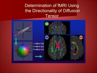 Determination of fMRI Using
the Directionality of Diffusion
Tensor
 