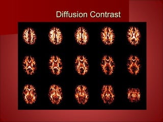 Diffusion ContrastDiffusion Contrast
 