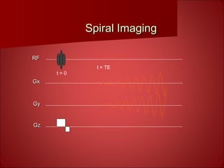 Spiral ImagingSpiral Imaging
t = TE
RFRF
GxGx
GyGy
GzGz
t = 0
 