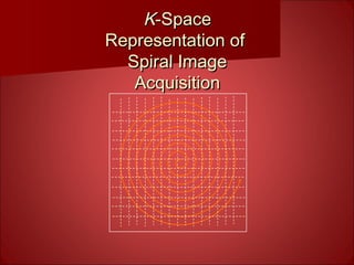 KK-Space-Space
Representation ofRepresentation of
Spiral ImageSpiral Image
AcquisitionAcquisition
 