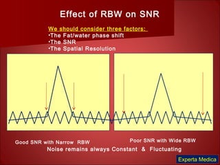 Effect of RBW on SNR
We should consider three factors:
•The Fat/water phase shift
•The SNR
•The Spatial Resolution
Good SNR with Narrow RBW Poor SNR with Wide RBW
Noise remains always Constant & Fluctuating
Experta Medica
 