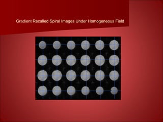 Gradient Recalled Spiral Images Under Homogeneous Field
 