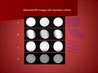 Distorted EPI Images with Imperfect x-Shim
A
B
C
D
 