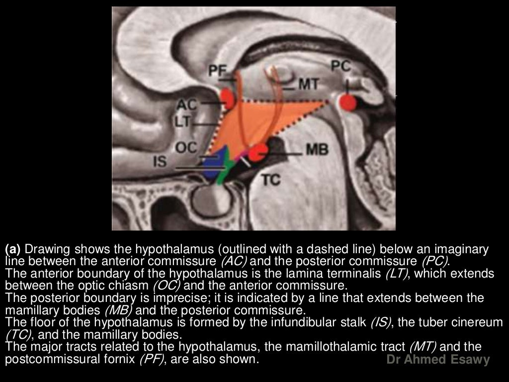 mri-imaging-hypothalamus-dr-ahmed-esawy