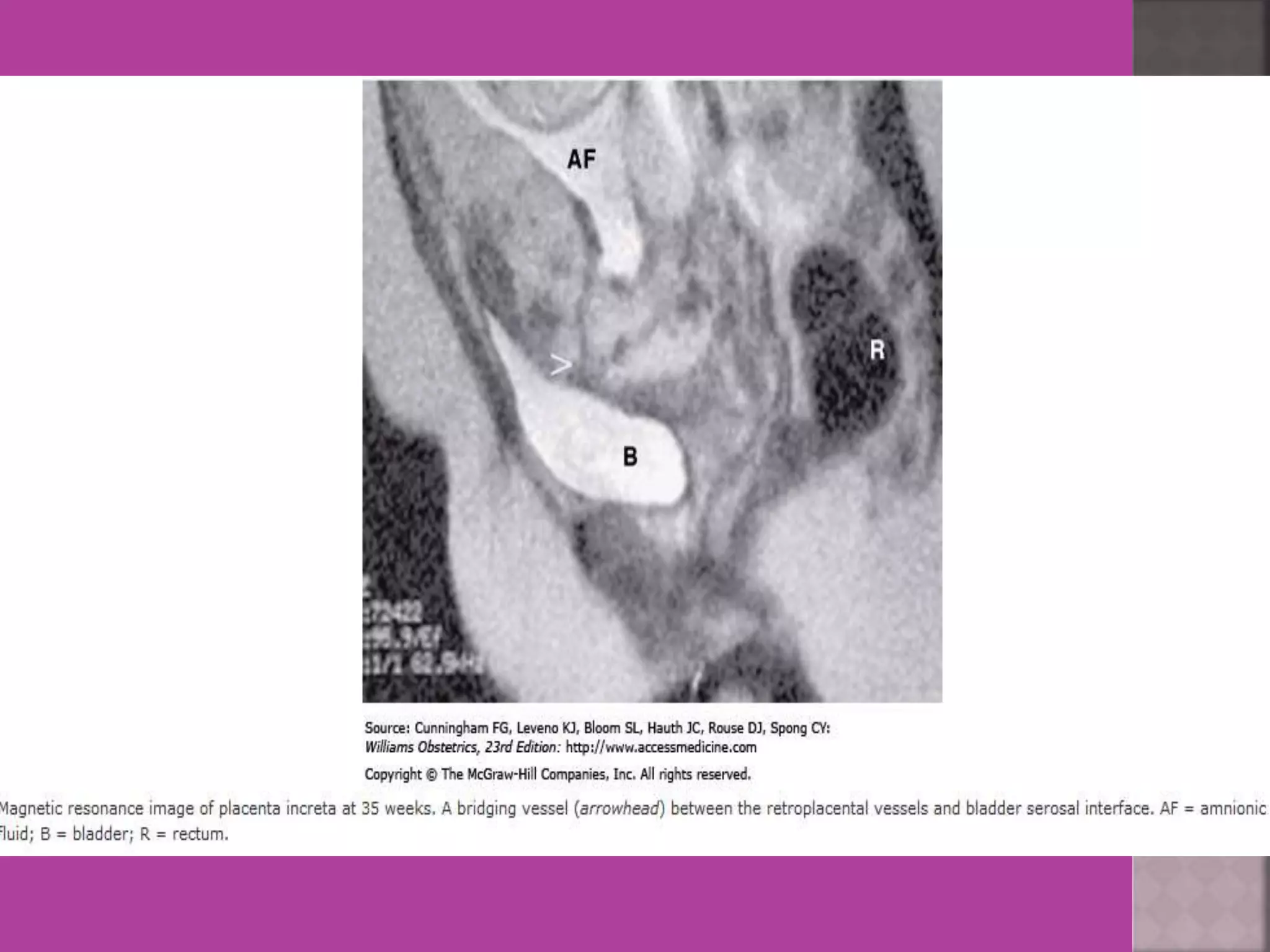 Mri in ob  gy practice